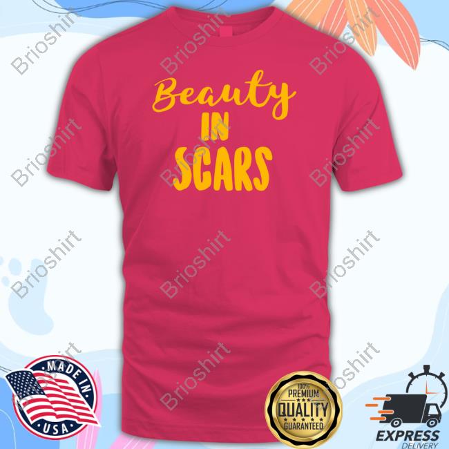 Official Kechi Okwuchi Beauty In Scars Custom T Shirts Official Kechi Okwuchi Beauty In Scars Custom T Shirts